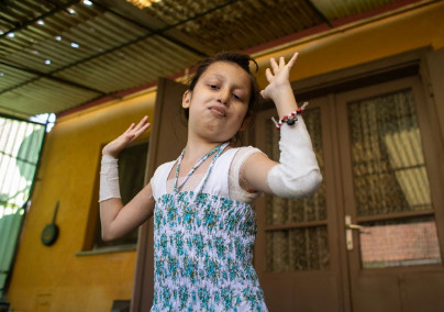Rangos díjat nyert a bőrbeteg kislányról készült fotósorozat