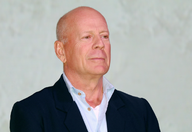 Döbbenetes lesifotók az afáziában szenvedő Bruce Willisről