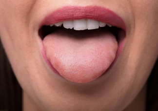A nyelvrák 4 tünete, ami azonnali kezelést igényel